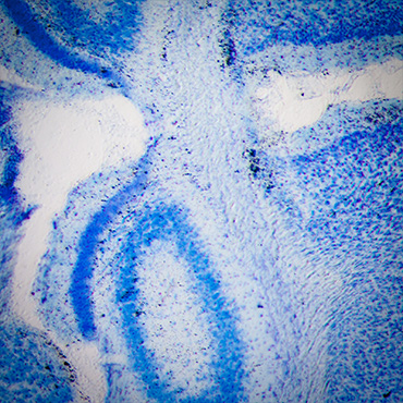 Microscopy rat brain hippocampal neurons